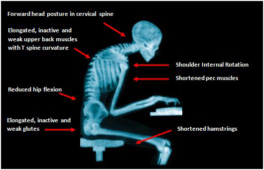 physical-anatomy-problems-sitting-computer-wrong-posture